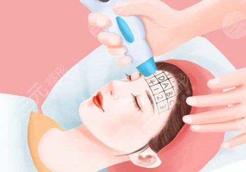 光電抗衰有沒有副作用？