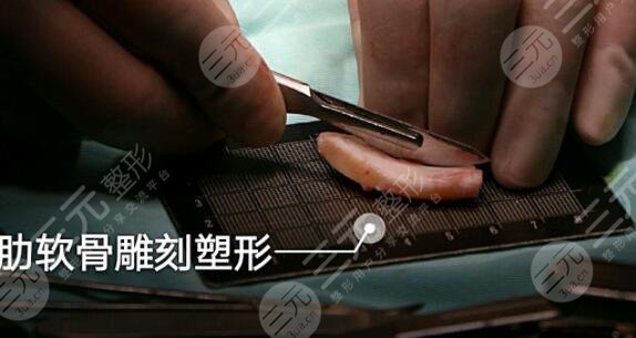 綜合鼻和肋骨鼻各自的優(yōu)勢有哪些?