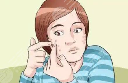 北京美萊醫(yī)療美容祛痘案例分享