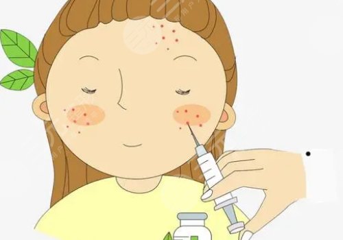 饅化針是什么針