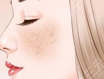 祛斑