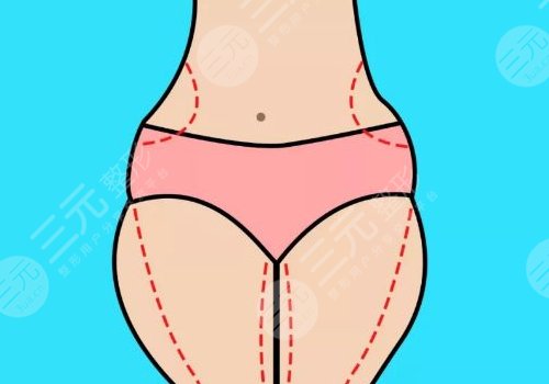 全身抽脂50斤的價格