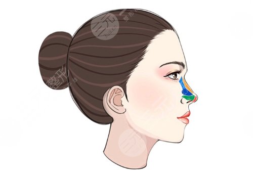 王天國醫(yī)生做鼻子怎樣