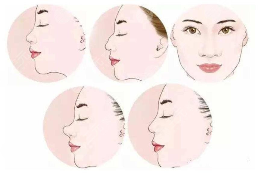 上海長海醫(yī)院整形外科隆鼻案例