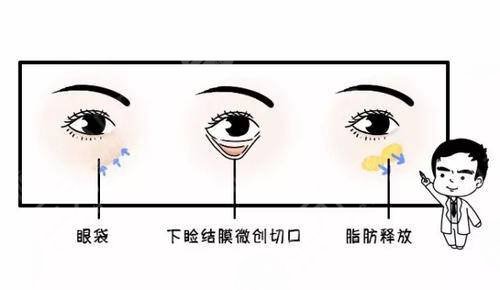 南京去眼袋整形術(shù)的費(fèi)用價格查詢！3家靠譜醫(yī)院可選~