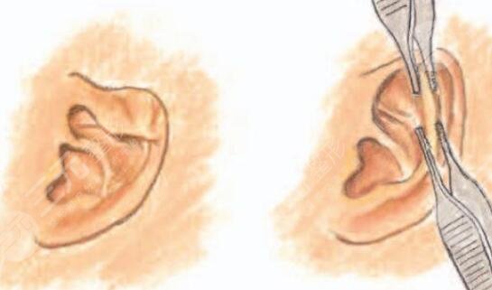 上海華美整形醫(yī)院擅長項目介紹