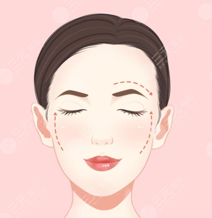 上海新華醫(yī)院美容整形額頭拉皮案例分享