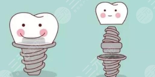 武漢同濟(jì)醫(yī)院種植牙多少錢