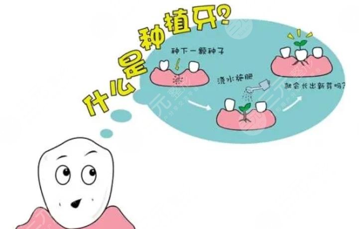 上海華山醫(yī)院牙齒種植費(fèi)用是多少