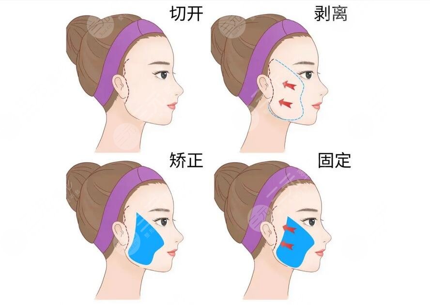 40歲抗衰老醫(yī)美項目有哪些？