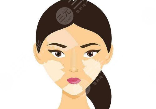 用什么土方治白斑？