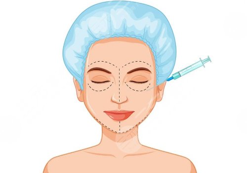 艾維嵐注射后多久消腫？