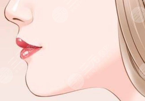 下顎整容手術(shù)一般要多少錢