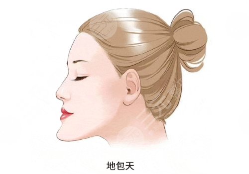 成人地包天手術整形費用多少