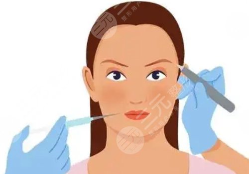 面部填充膠原蛋白多少錢？