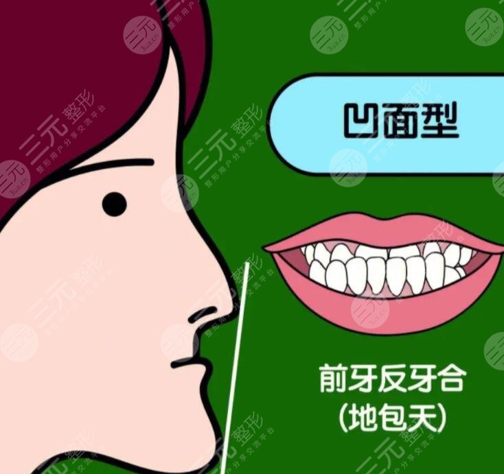 成人地包天手術整形費用多少錢？2023年市場均價1-3萬不等~