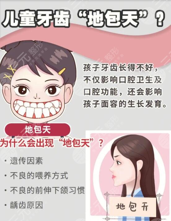 成人地包天手術整形的方式有哪些?