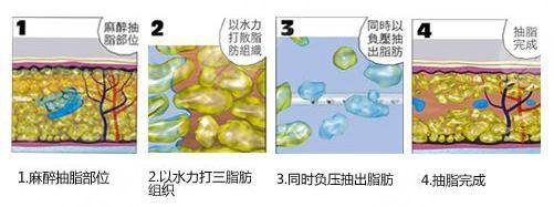 上海仁愛醫(yī)院美容外科擅長(zhǎng)項(xiàng)目科普