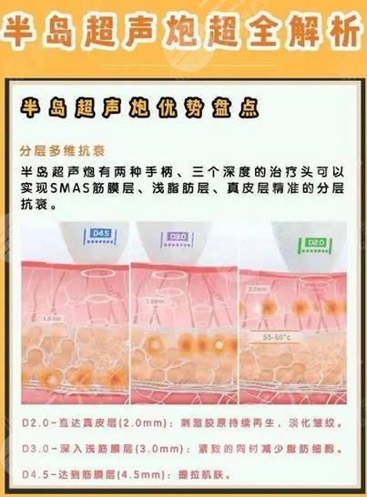 半島黃金超聲炮和超聲炮的區(qū)別有哪些？