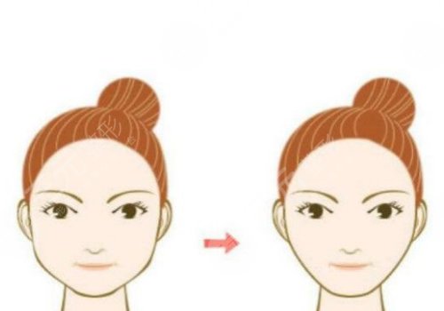 削骨三年后的真實案例