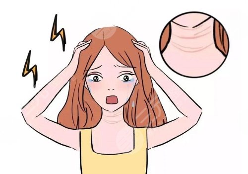 頸部皮膚松弛有什么辦法可以改良？