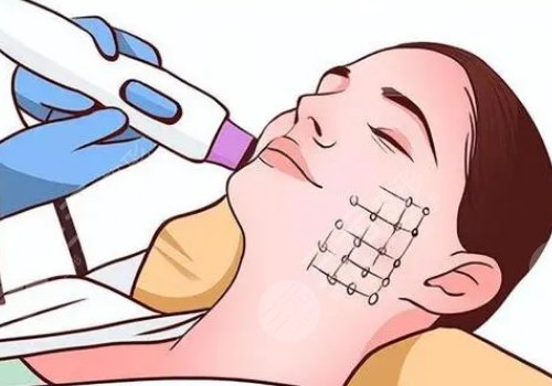 熱瑪吉是不是能量越高效果越好？