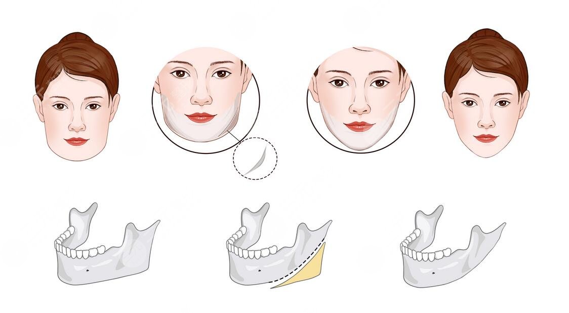 中山大學(xué)光華口腔醫(yī)學(xué)院附屬口腔醫(yī)院