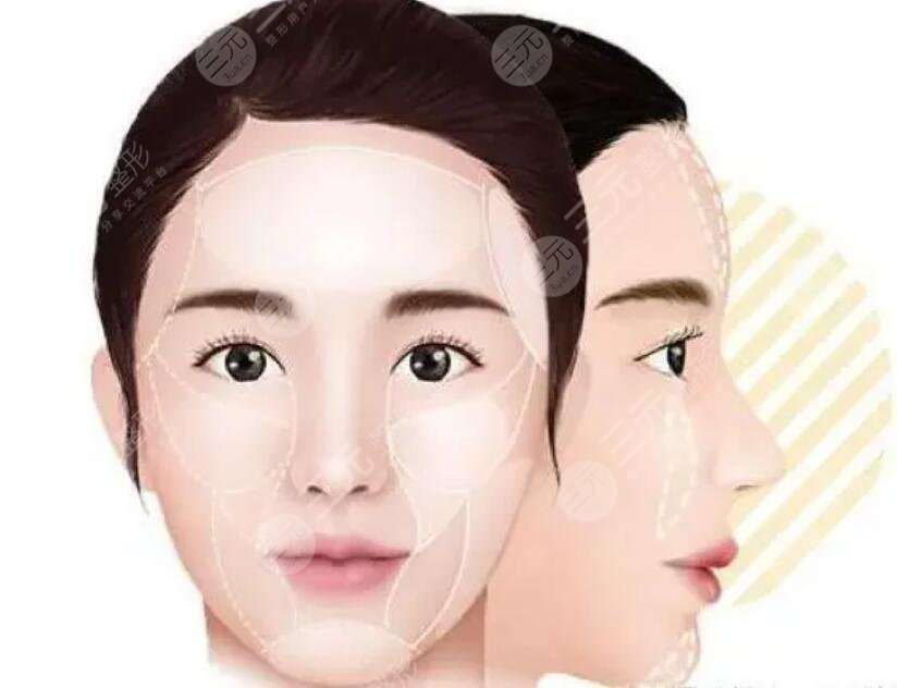 饅化臉是怎么形成的？