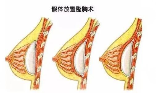 廣州荔灣人民醫(yī)院整形科項(xiàng)目介紹