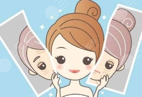 馬剛醫(yī)生激光美容案例