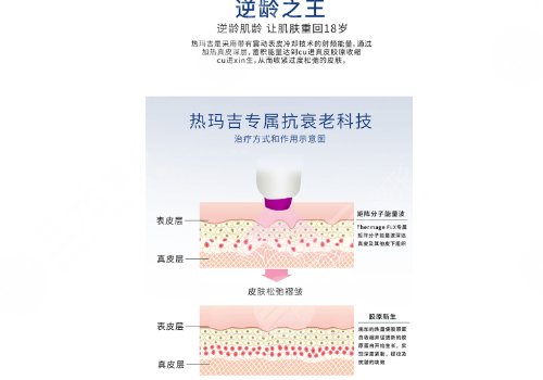饅化臉做熱瑪吉好還是超聲炮好