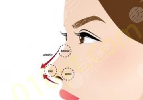 強生瑆珀假體缺點