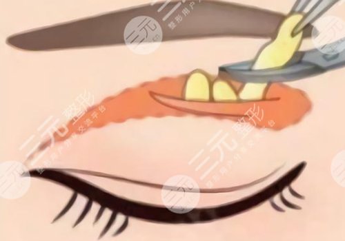 昆明劉哲延眼修復(fù)案例圖片