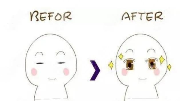 彭才學(xué)醫(yī)生雙眼皮案例