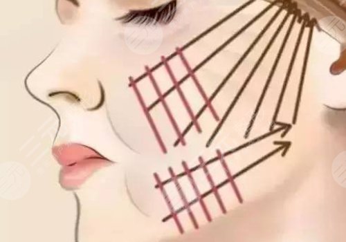 姨化臉是什么意思