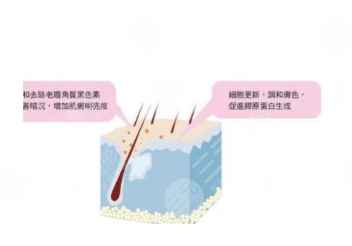 鐳射凈膚儀祛斑會反彈嗎