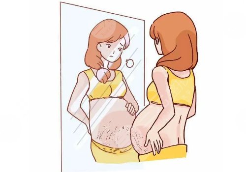 妊娠紋修復需要多少錢