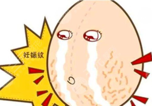 妊娠紋修復需要多少錢