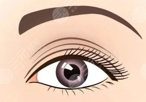 楊繼紅跟莊蔚強(qiáng)雙眼皮那個(gè)做的好