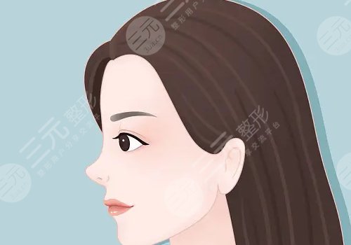 楊繼紅跟莊蔚強(qiáng)雙眼皮那個(gè)做的好