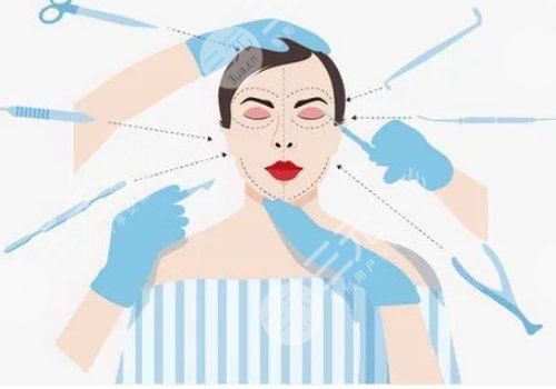 楊瑞年2023年雙眼皮成功案例