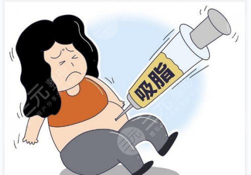 昆明宋俊輝吸脂