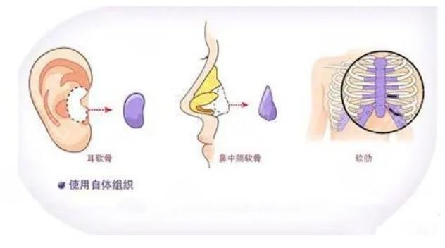 北京八大處整形外科醫(yī)院特色項目