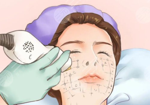 光電抗衰有沒有副作用？