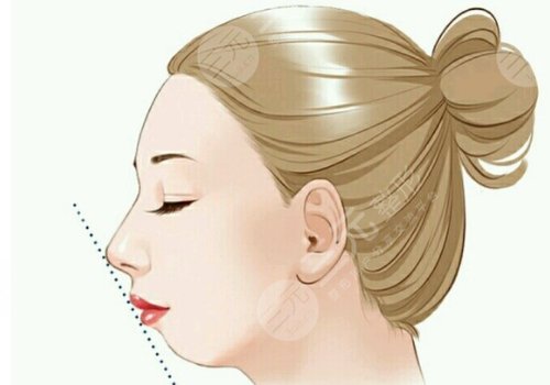 昆醫(yī)附二院張景波簡介