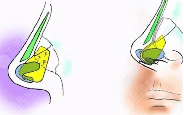 北京美萊醫(yī)療美容醫(yī)院擅長項(xiàng)目