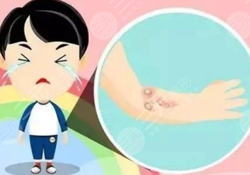 去色素疤痕好的方法