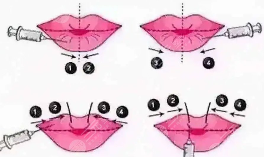 華西醫(yī)院整形科價目表新2023