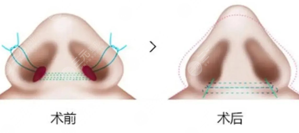 華西醫(yī)院整形科價目表新2023