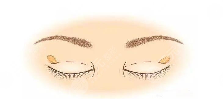 上海鄒功偉醫(yī)生簡(jiǎn)介-技術(shù)特色